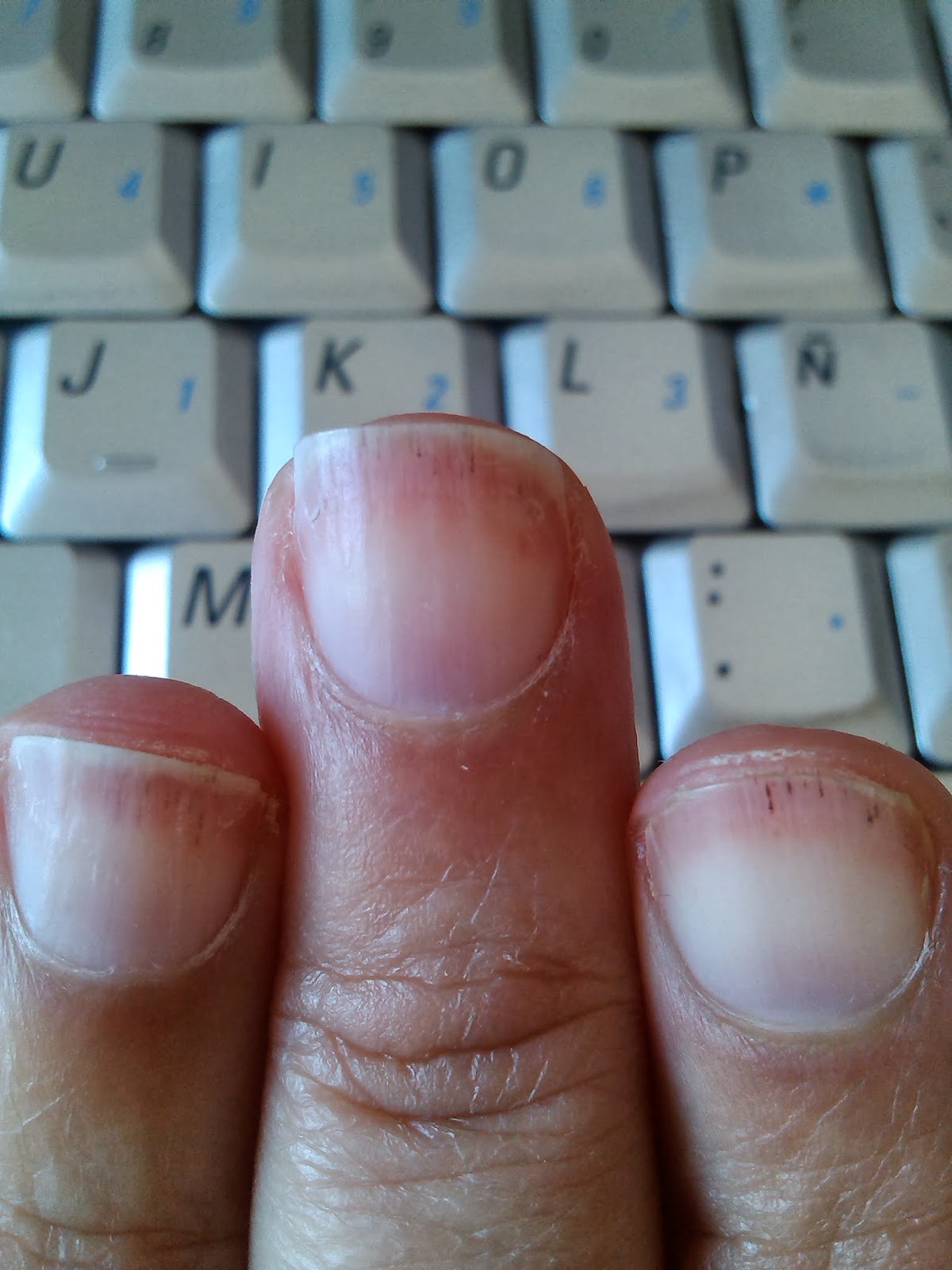 uñas de gel muy cortas